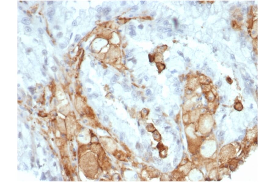 Immunohistochemistry - Anti-IL-2 Antibody [IL2/7050R] (A278006) - Antibodies.com