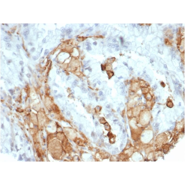 Immunohistochemistry - Anti-IL-2 Antibody [IL2/7050R] (A278006) - Antibodies.com