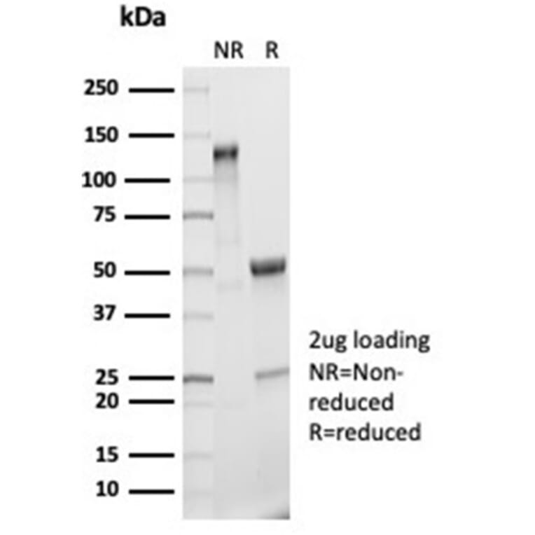 SDS-PAGE - Anti-IL-2 Antibody [IL2/7050R] (A278006) - Antibodies.com