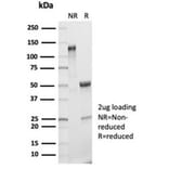 SDS-PAGE - Anti-IL-2 Antibody [IL2/7050R] (A278006) - Antibodies.com
