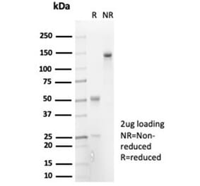 SDS-PAGE - Anti-IL-7 Antibody [IL7/7053R] (A278007) - Antibodies.com