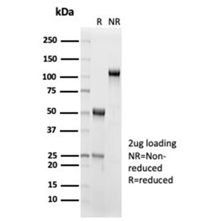 SDS-PAGE - Anti-IL-15 Antibody [IL15/7048R] (A278008) - Antibodies.com