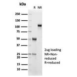 SDS-PAGE - Anti-IL-15 Antibody [IL15/7048R] (A278008) - Antibodies.com