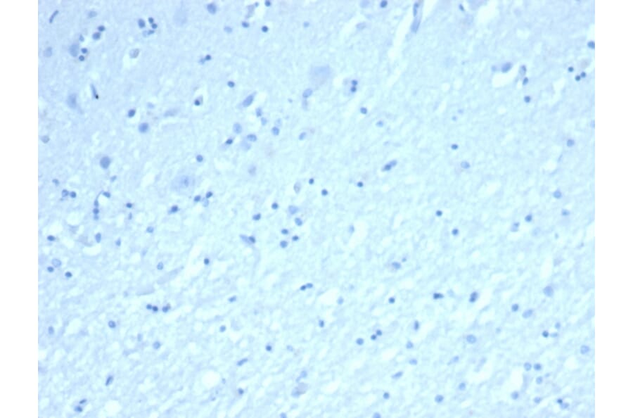 Immunohistochemistry - Anti-Inhibin alpha Antibody [INHA/6598R] (A278010) - Antibodies.com