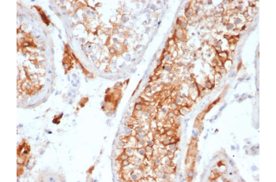 Immunohistochemistry - Anti-Inhibin alpha Antibody [INHA/6598R] (A278010) - Antibodies.com