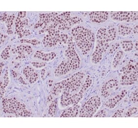 Immunohistochemistry - Anti-INSM1 Antibody [INSM1/6286R] (A278011) - Antibodies.com