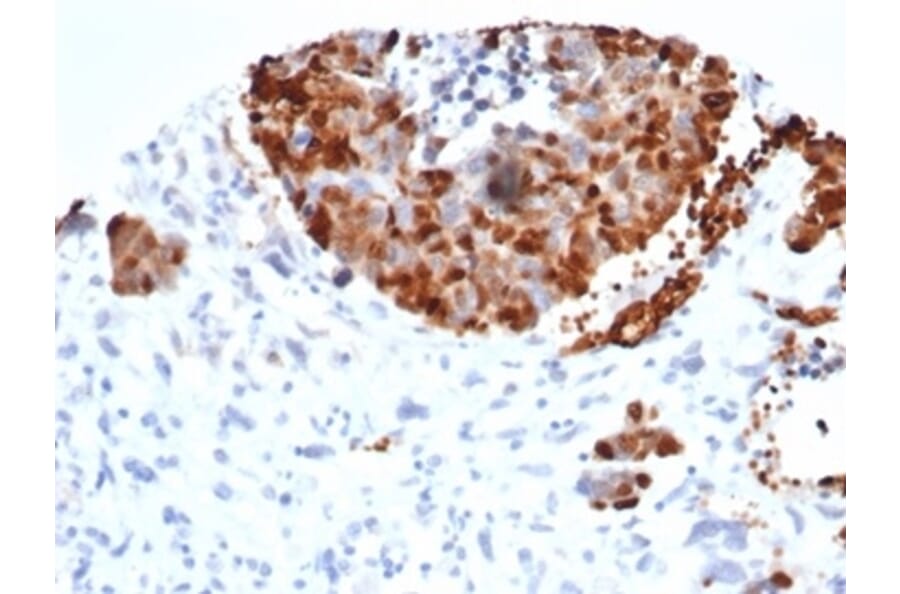Immunohistochemistry - Anti-INSM1 Antibody [INSM1/6286R] (A278011) - Antibodies.com