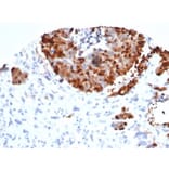 Immunohistochemistry - Anti-INSM1 Antibody [INSM1/6286R] (A278011) - Antibodies.com