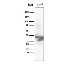Western Blot - Anti-Arginase 1 Antibody [ARG1/6790R] (A278012) - Antibodies.com