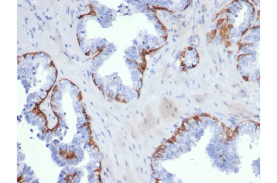 Immunohistochemistry - Anti-Cytokeratin 5 Antibody [KRT5/6399R] (A278013) - Antibodies.com
