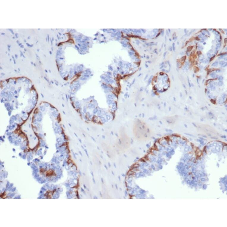 Immunohistochemistry - Anti-Cytokeratin 5 Antibody [KRT5/6399R] (A278013) - Antibodies.com