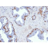 Immunohistochemistry - Anti-Cytokeratin 5 Antibody [KRT5/6399R] (A278013) - Antibodies.com