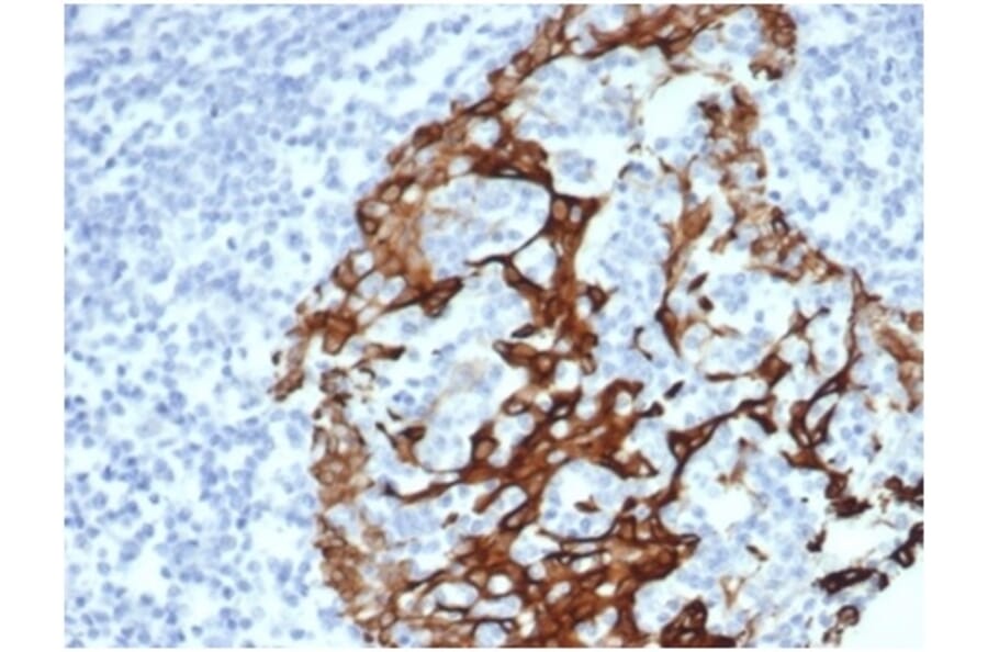 Immunohistochemistry - Anti-Cytokeratin 6A Antibody [KRT6/3997R] (A278014) - Antibodies.com