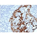 Immunohistochemistry - Anti-Cytokeratin 6A Antibody [KRT6/3997R] (A278014) - Antibodies.com