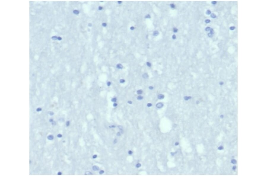 Immunohistochemistry - Anti-Cytokeratin 6A Antibody [KRT6/3997R] (A278014) - Antibodies.com