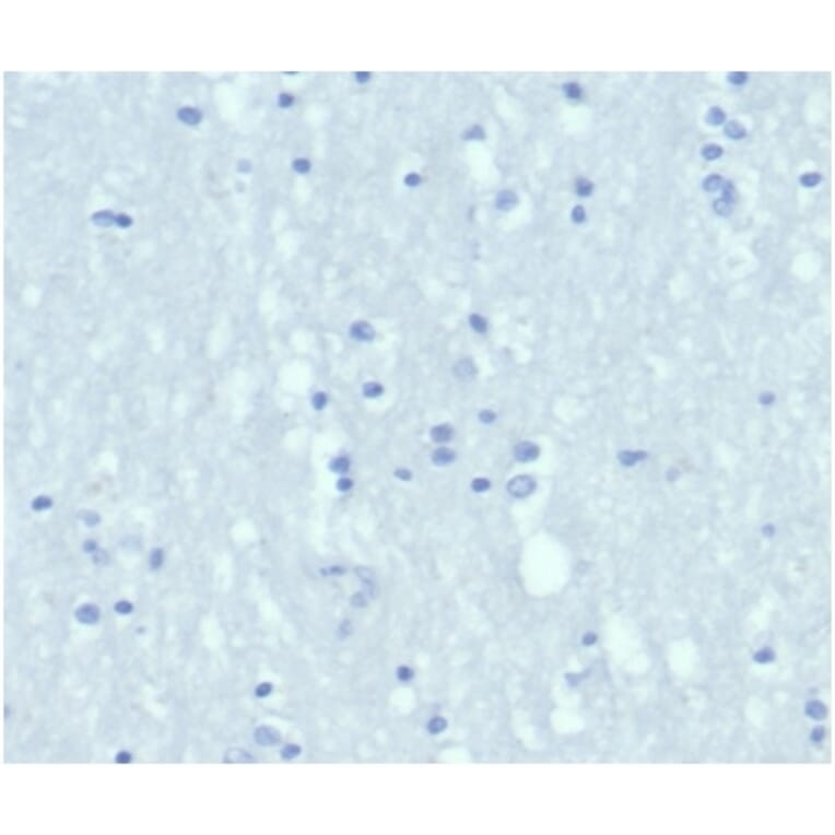 Immunohistochemistry - Anti-Cytokeratin 6A Antibody [KRT6/3997R] (A278014) - Antibodies.com