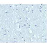 Immunohistochemistry - Anti-Cytokeratin 6A Antibody [KRT6/3997R] (A278014) - Antibodies.com