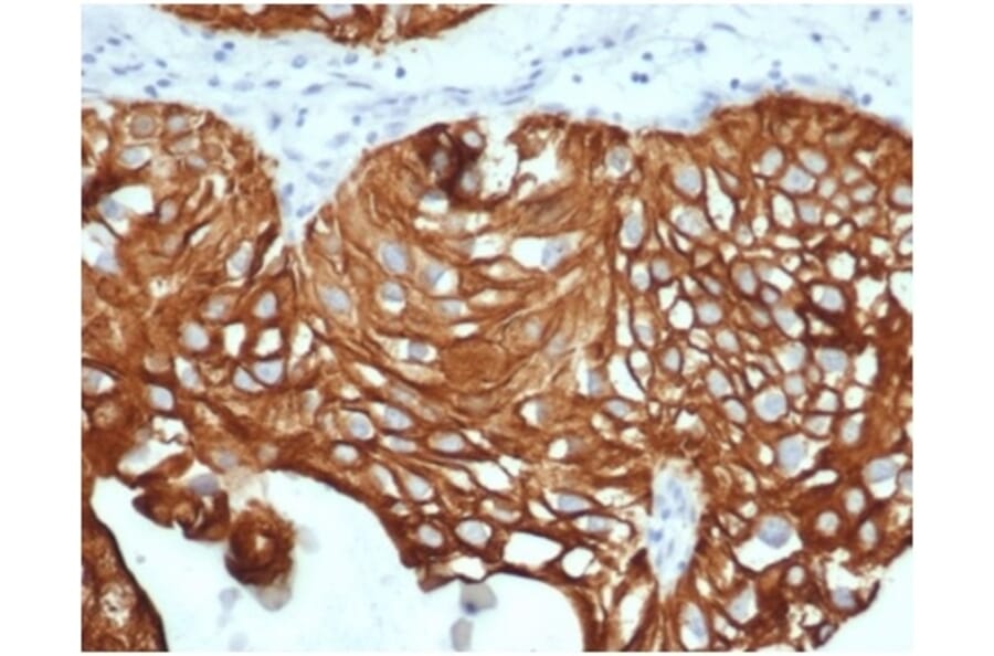 Immunohistochemistry - Anti-Cytokeratin 7 Antibody [KRT7/4387R] (A278015) - Antibodies.com