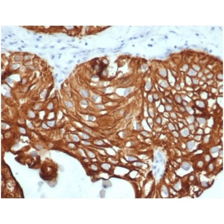 Immunohistochemistry - Anti-Cytokeratin 7 Antibody [KRT7/4387R] (A278015) - Antibodies.com