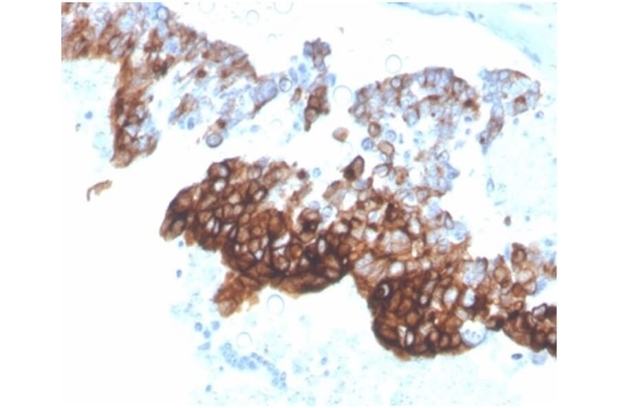 Immunohistochemistry - Anti-Cytokeratin 7 Antibody [KRT7/4387R] (A278015) - Antibodies.com