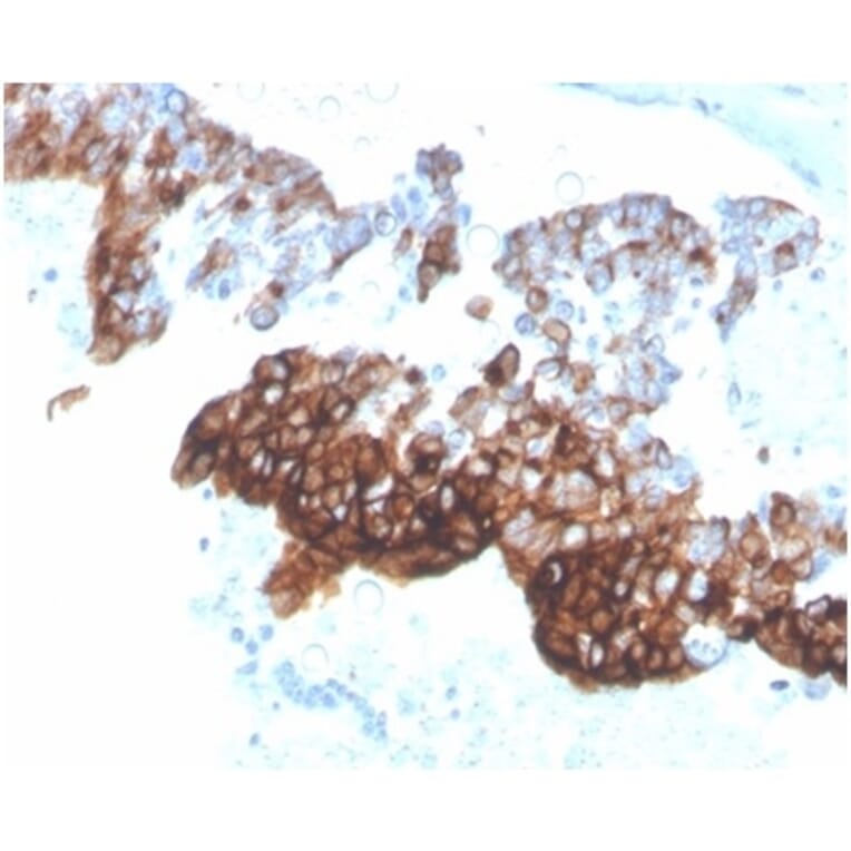 Immunohistochemistry - Anti-Cytokeratin 7 Antibody [KRT7/4387R] (A278015) - Antibodies.com