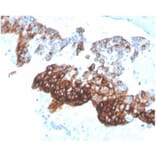 Immunohistochemistry - Anti-Cytokeratin 7 Antibody [KRT7/4387R] (A278015) - Antibodies.com