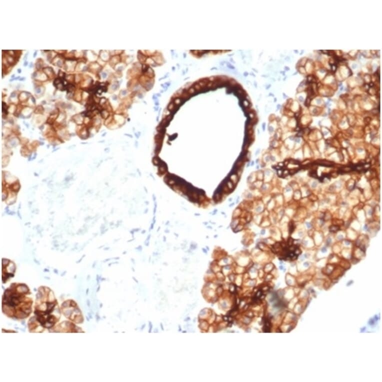 Immunohistochemistry - Anti-Cytokeratin 7 Antibody [KRT7/4387R] (A278015) - Antibodies.com