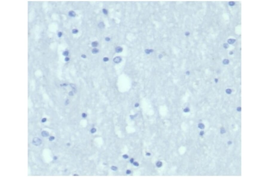 Immunohistochemistry - Anti-Cytokeratin 7 Antibody [KRT7/4387R] (A278015) - Antibodies.com