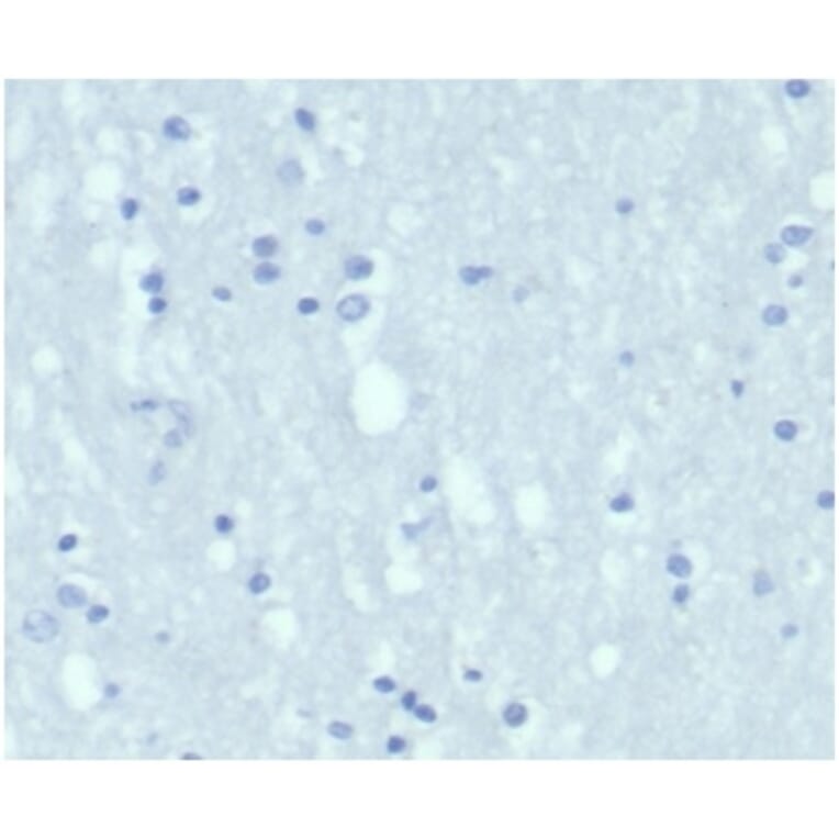 Immunohistochemistry - Anti-Cytokeratin 7 Antibody [KRT7/4387R] (A278015) - Antibodies.com