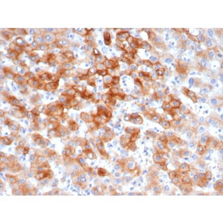 Immunohistochemistry - Anti-Cytokeratin 8 Antibody [KRT8/6472R] (A278017) - Antibodies.com