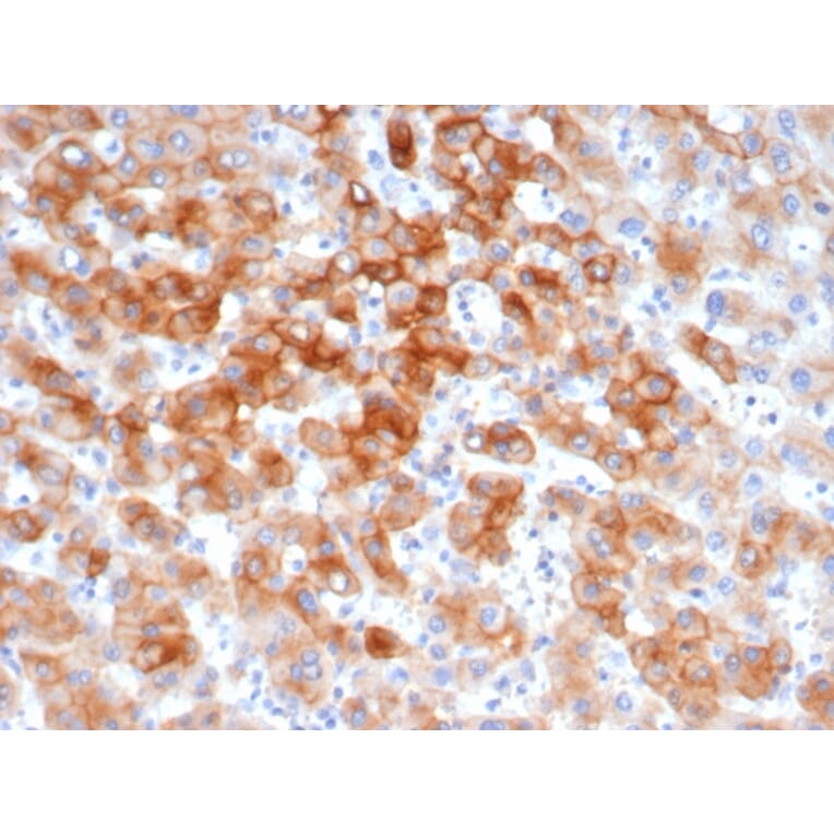 Immunohistochemistry - Anti-Cytokeratin 8 Antibody [KRT8/6472R] (A278017) - Antibodies.com