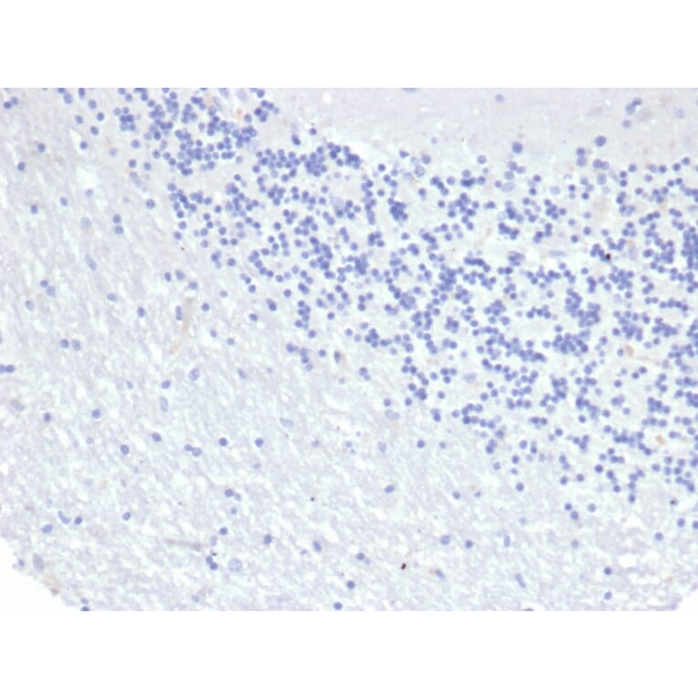 Immunohistochemistry - Anti-Cytokeratin 8 Antibody [KRT8/6472R] (A278017) - Antibodies.com