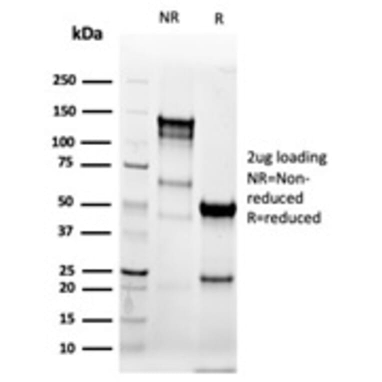SDS-PAGE - Anti-Cytokeratin 8 Antibody [KRT8/6472R] (A278017) - Antibodies.com