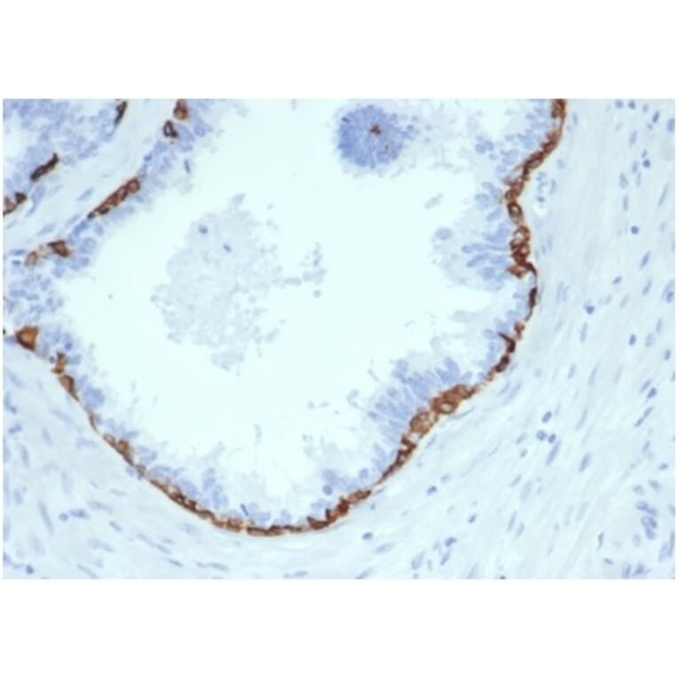 Immunohistochemistry - Anti-Cytokeratin 14 Antibody [KRT14/4584R] (A278018) - Antibodies.com
