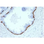 Immunohistochemistry - Anti-Cytokeratin 14 Antibody [KRT14/4584R] (A278018) - Antibodies.com
