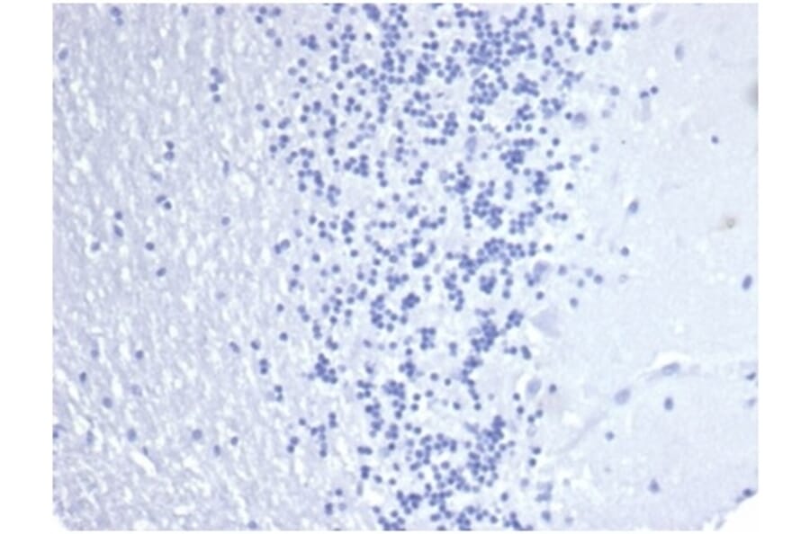 Immunohistochemistry - Anti-Cytokeratin 14 Antibody [KRT14/4584R] (A278018) - Antibodies.com