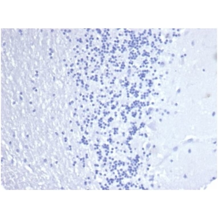 Immunohistochemistry - Anti-Cytokeratin 14 Antibody [KRT14/4584R] (A278018) - Antibodies.com