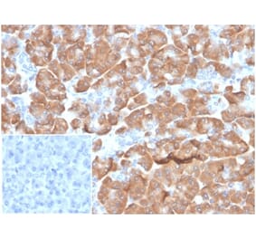 Immunohistochemistry - Anti-67kDa Laminin Receptor Antibody [RPSA/6332R] (A278020) - Antibodies.com
