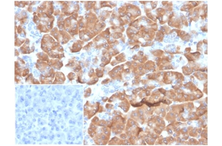 Immunohistochemistry - Anti-67kDa Laminin Receptor Antibody [RPSA/6332R] (A278020) - Antibodies.com