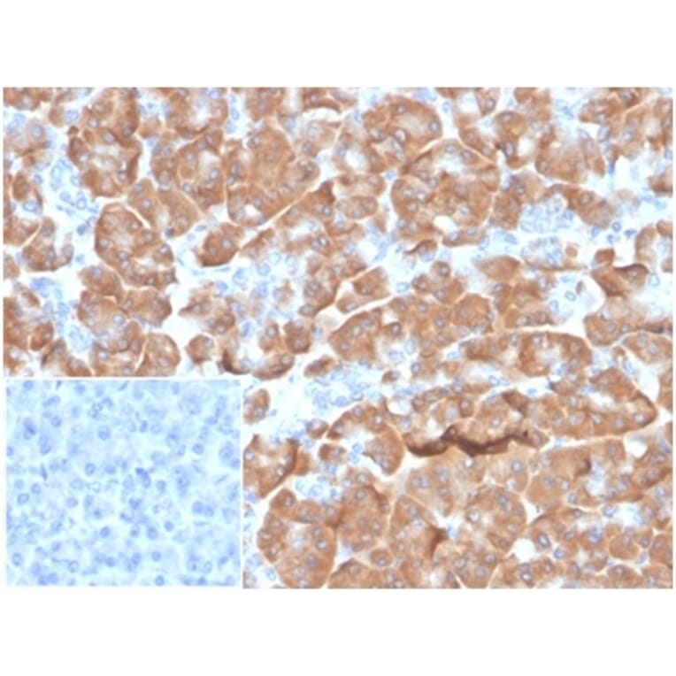 Immunohistochemistry - Anti-67kDa Laminin Receptor Antibody [RPSA/6332R] (A278020) - Antibodies.com