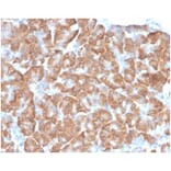 Immunohistochemistry - Anti-67kDa Laminin Receptor Antibody [RPSA/6332R] (A278020) - Antibodies.com