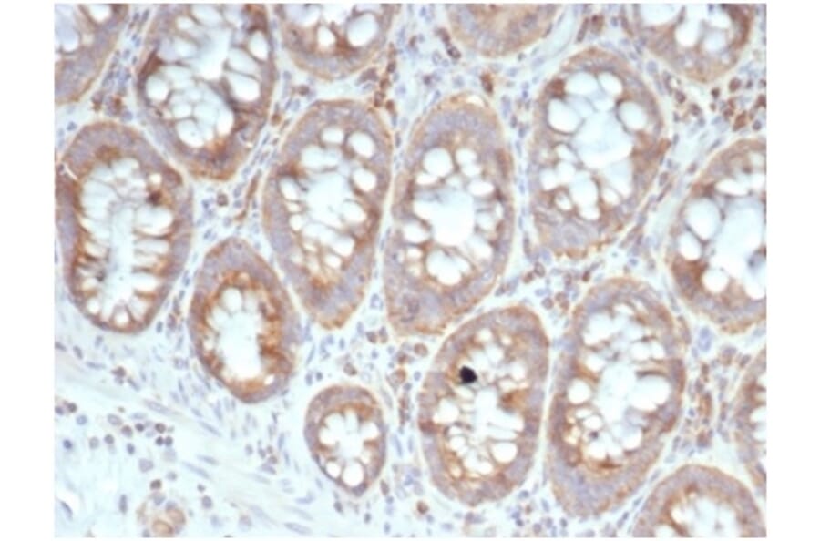 Immunohistochemistry - Anti-67kDa Laminin Receptor Antibody [RPSA/6332R] (A278020) - Antibodies.com