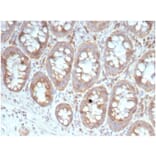 Immunohistochemistry - Anti-67kDa Laminin Receptor Antibody [RPSA/6332R] (A278020) - Antibodies.com