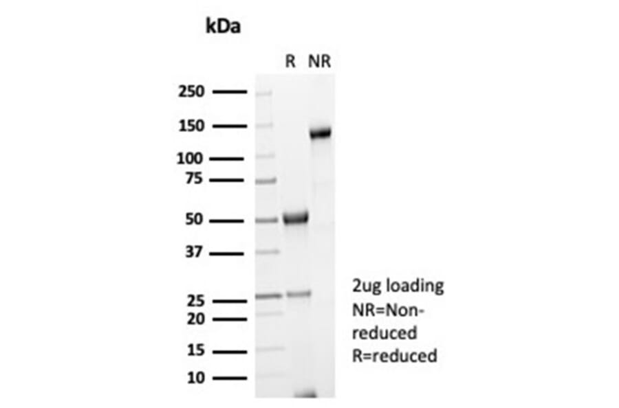 SDS-PAGE - Anti-Galectin 3 Antibody [LGALS3/7036R] (A278021) - Antibodies.com