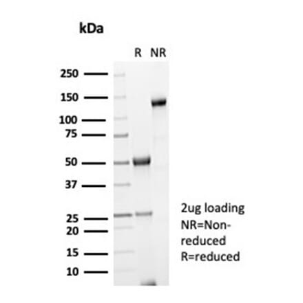 SDS-PAGE - Anti-Galectin 3 Antibody [LGALS3/7036R] (A278021) - Antibodies.com