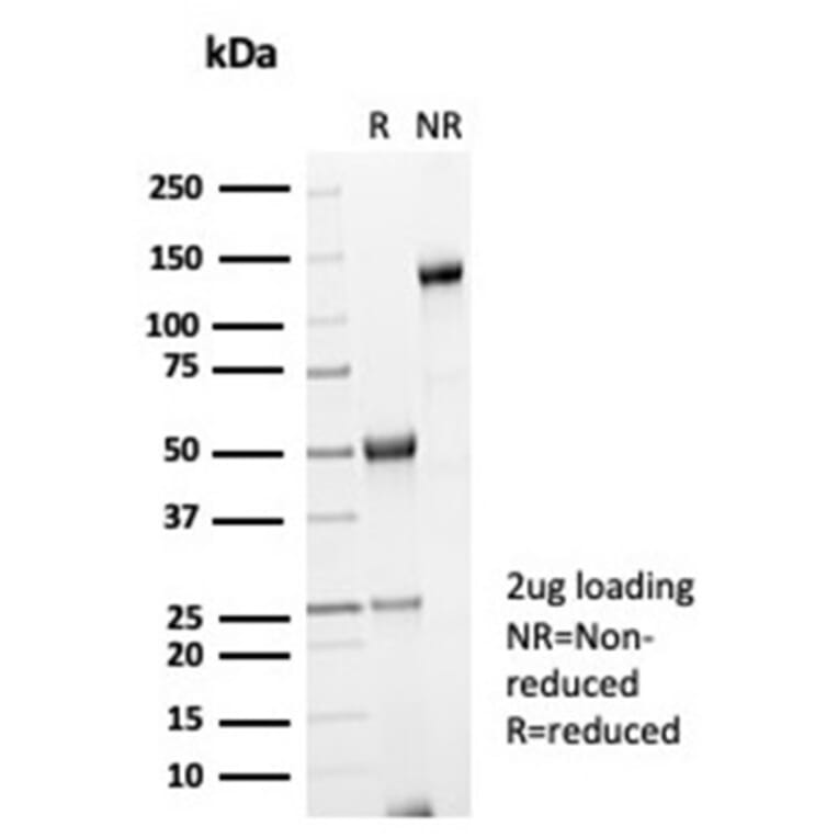 SDS-PAGE - Anti-Galectin 3 Antibody [LGALS3/7036R] (A278021) - Antibodies.com