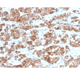 Immunohistochemistry - Anti-Luteinizing Hormone beta Antibody [LHb/1612R] (A278022) - Antibodies.com
