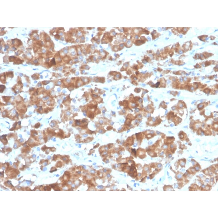 Immunohistochemistry - Anti-Luteinizing Hormone beta Antibody [LHb/1612R] (A278022) - Antibodies.com