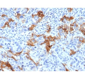 Immunohistochemistry - Anti-TROP2 Antibody [TACSTD2/6394R] (A278023) - Antibodies.com