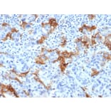 Immunohistochemistry - Anti-TROP2 Antibody [TACSTD2/6394R] (A278023) - Antibodies.com